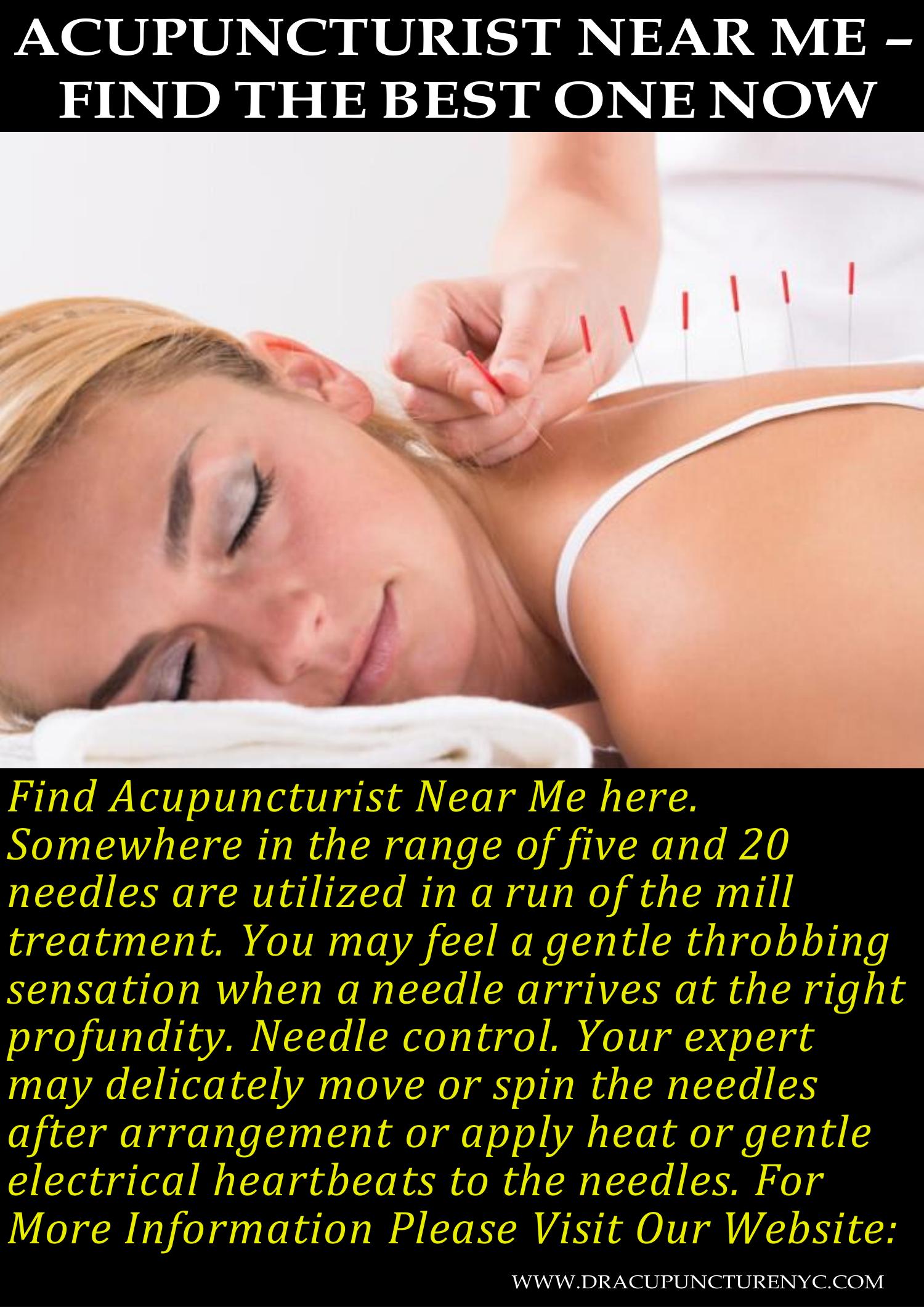 Acupuncturist Near Me Find The Best One Now Docx DocDroid