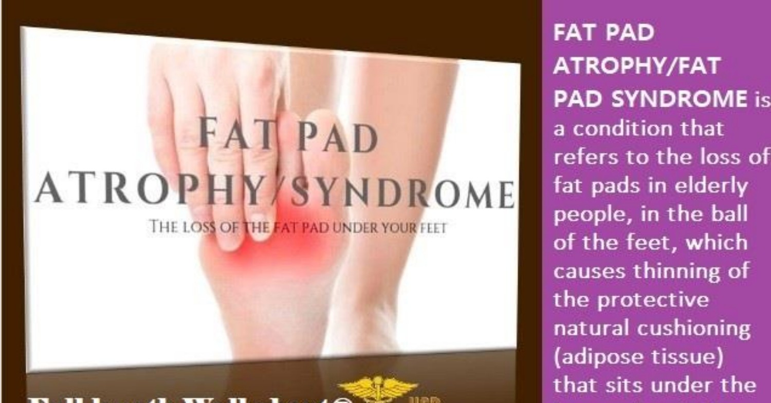 FAT PAD ATROPHY OR LOSS OF ADIPOSE TISSUE Pdf DocDroid