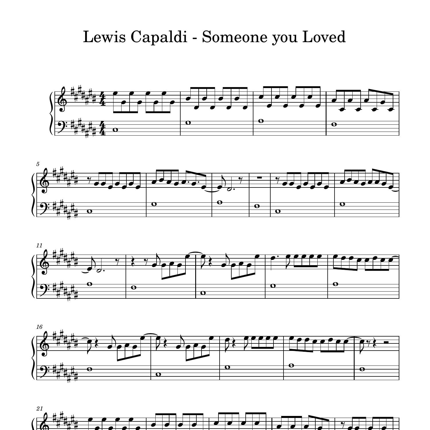 Lewis Capaldi Someone You Loved Pdf DocDroid