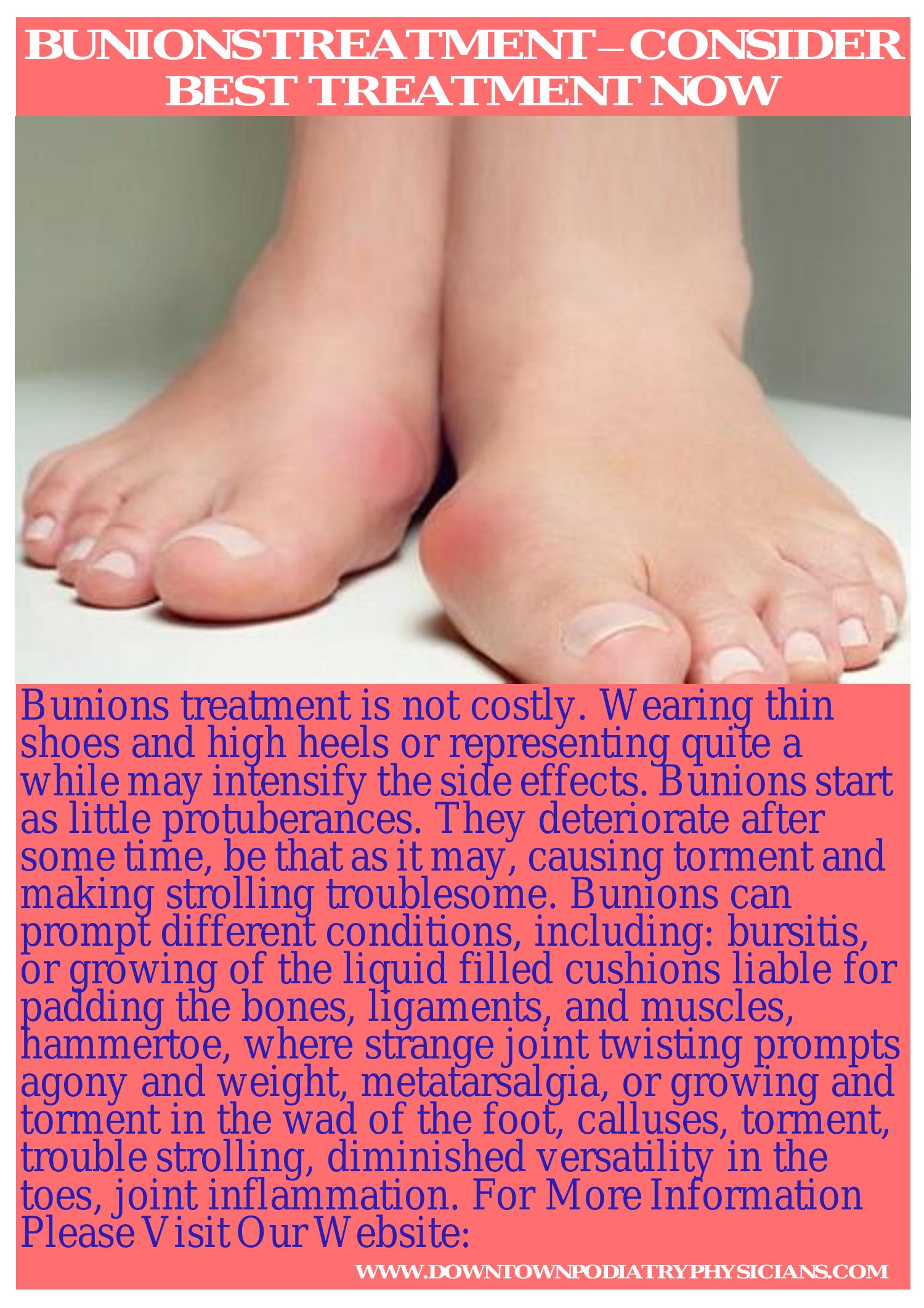 Bunions Treatment Consider Best Treatment Now Converted Docx Docdroid