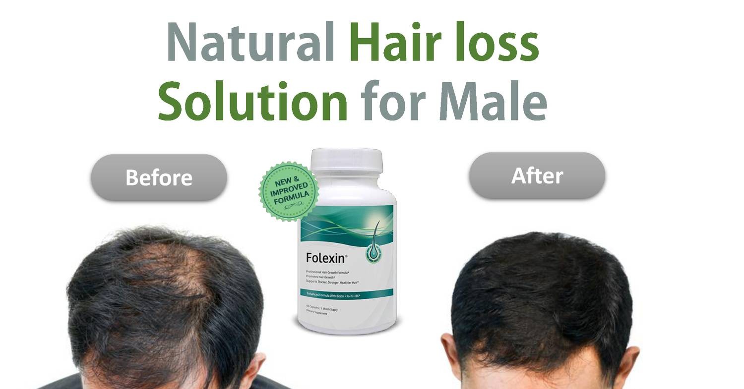 Folexin Hair Loss Solution For Menpdf Docdroid 3073