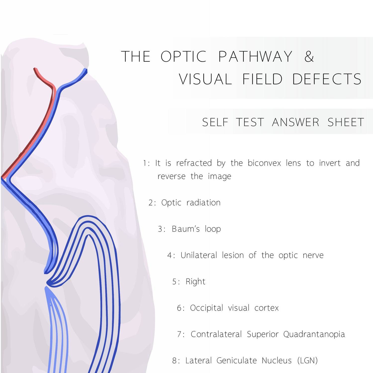 Visual Field Pathway Defects