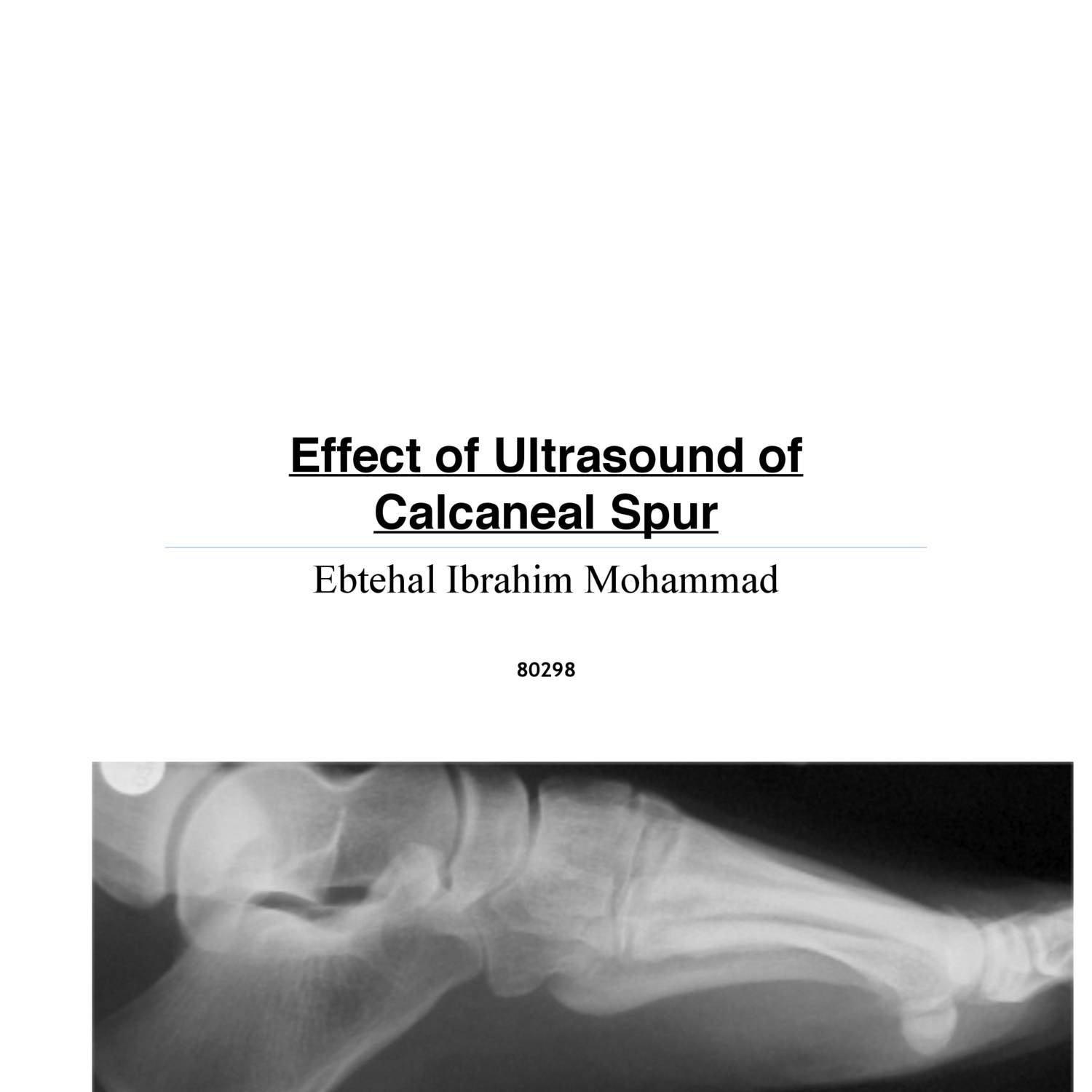 Calcaneal spur clearance ultrasound