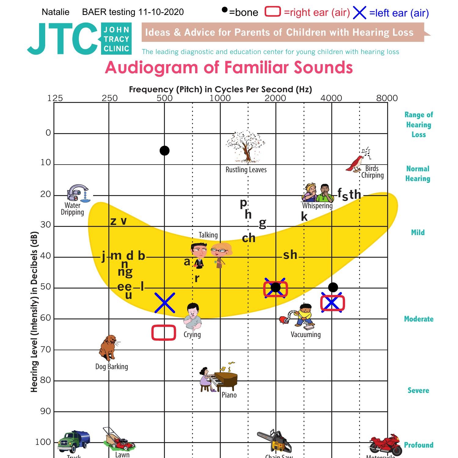 familiar-sounds-audiogram-natalie-pdf-docdroid