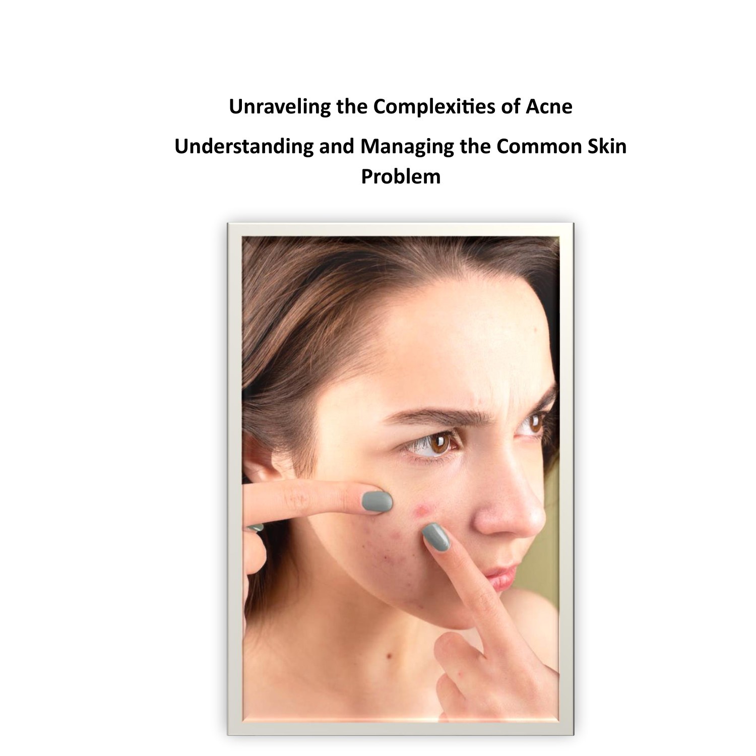 Unraveling the Complexities of Acne.pdf  DocDroid