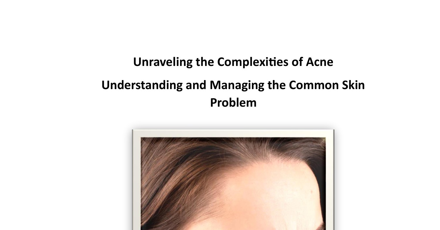 Unraveling the Complexities of Acne.pdf  DocDroid